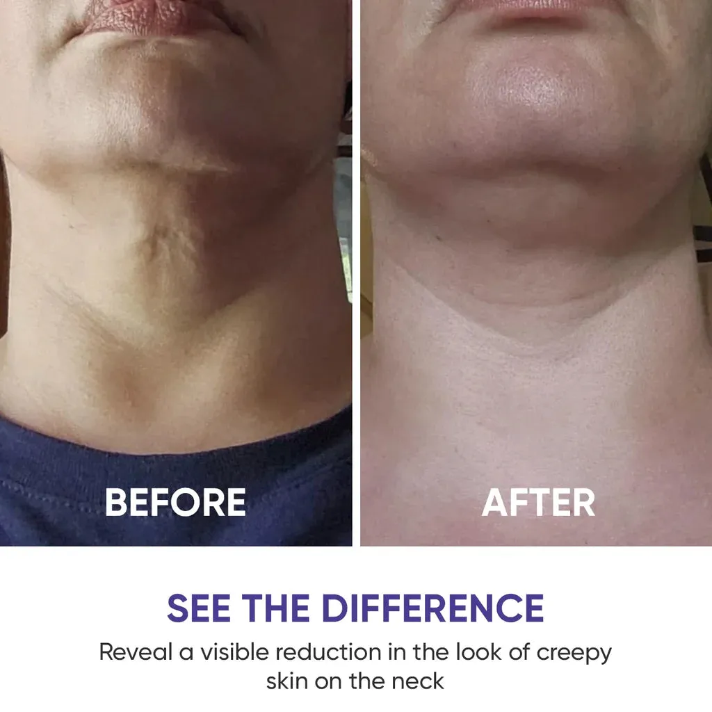 Tighten & Lift Neck Cream