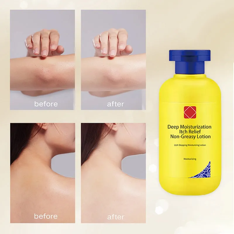 Winter Discount-50% OFFDeep Moisturization Itch Relief Non-Greasy Lotion